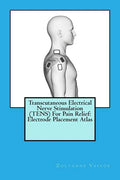 Transcutaneous Electrical Nerve Stimulation (TENS) For Pain Relief: Electrode Placement Atlas - Paperback