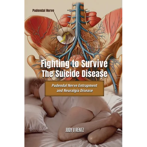 Fighting to Survive The Suicide Disease: Pudendal Nerve Entrapment and Neuralgia Disease - Paperback